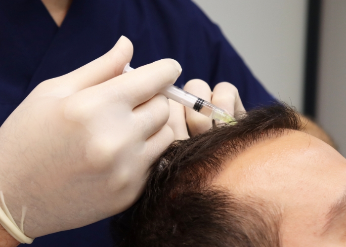 No Instituto Shalon identificamos as causas da queda de cabelos e alopecia, oferecendo tratamentos personalizados para restaurar a saúde capilar. Fale conosco e saiba mais!